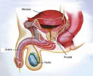 Prostat Büyümesi (BPH)